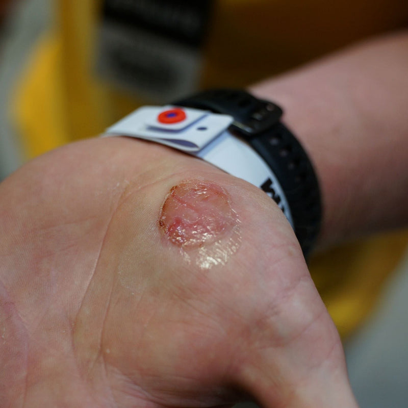 Load image into Gallery viewer, Element 26 - Rip Repair