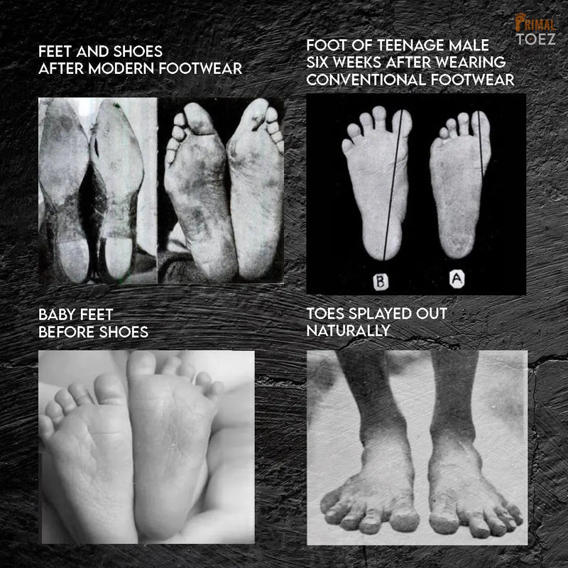 Load image into Gallery viewer, Primal Toez (by Alpha Gripz) - Walkabouts (Active Toe Spacers)