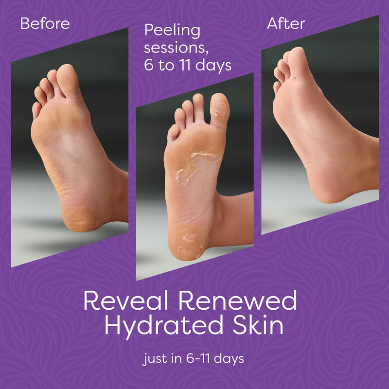 Load image into Gallery viewer, Reathlete - Aesta 3-in-1 Foot Peel Mask, Full-Cycle Foot Care: Revitalizing Mousse + Feet Peeling Mask + Moisturizing Cream | All-Natural Foot Peel Mask for Dry Cracked Feet | Baby Feet Foot Peel Treatment Set
