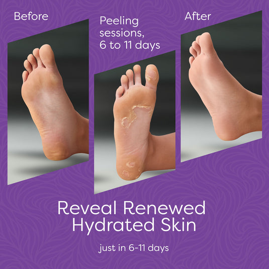 Reathlete - Aesta 3-in-1 Foot Peel Mask, Full-Cycle Foot Care: Revitalizing Mousse + Feet Peeling Mask + Moisturizing Cream | All-Natural Foot Peel Mask for Dry Cracked Feet | Baby Feet Foot Peel Treatment Set