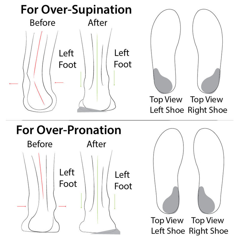 Load image into Gallery viewer, Heel Wedge  (Re-Usable, Adhesive)
