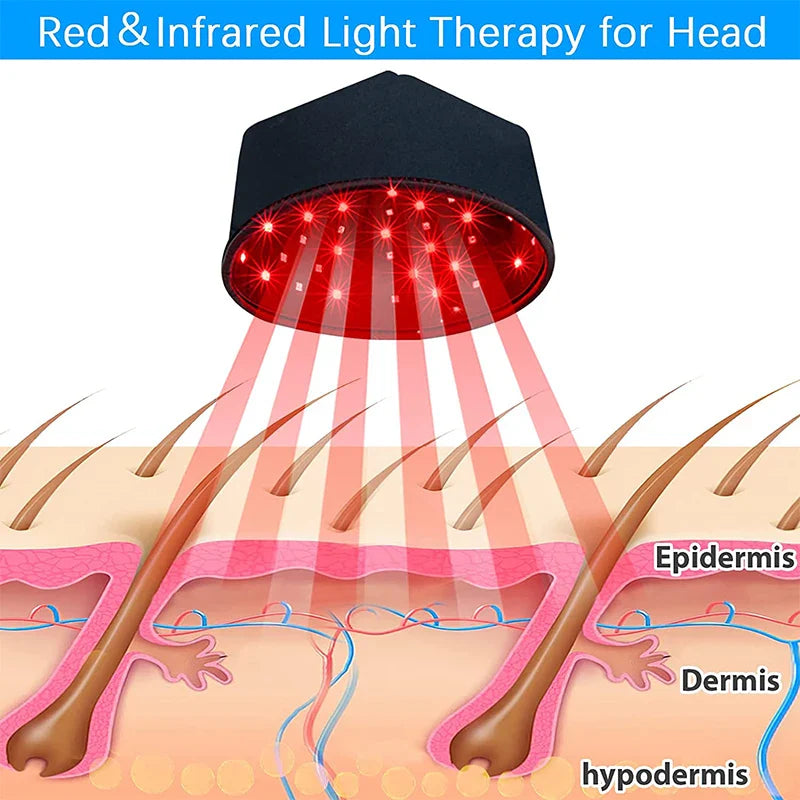 Load image into Gallery viewer, iReliev - Red Light Therapy Hair Growth Cap
