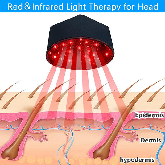 iReliev - Red Light Therapy Hair Growth Cap